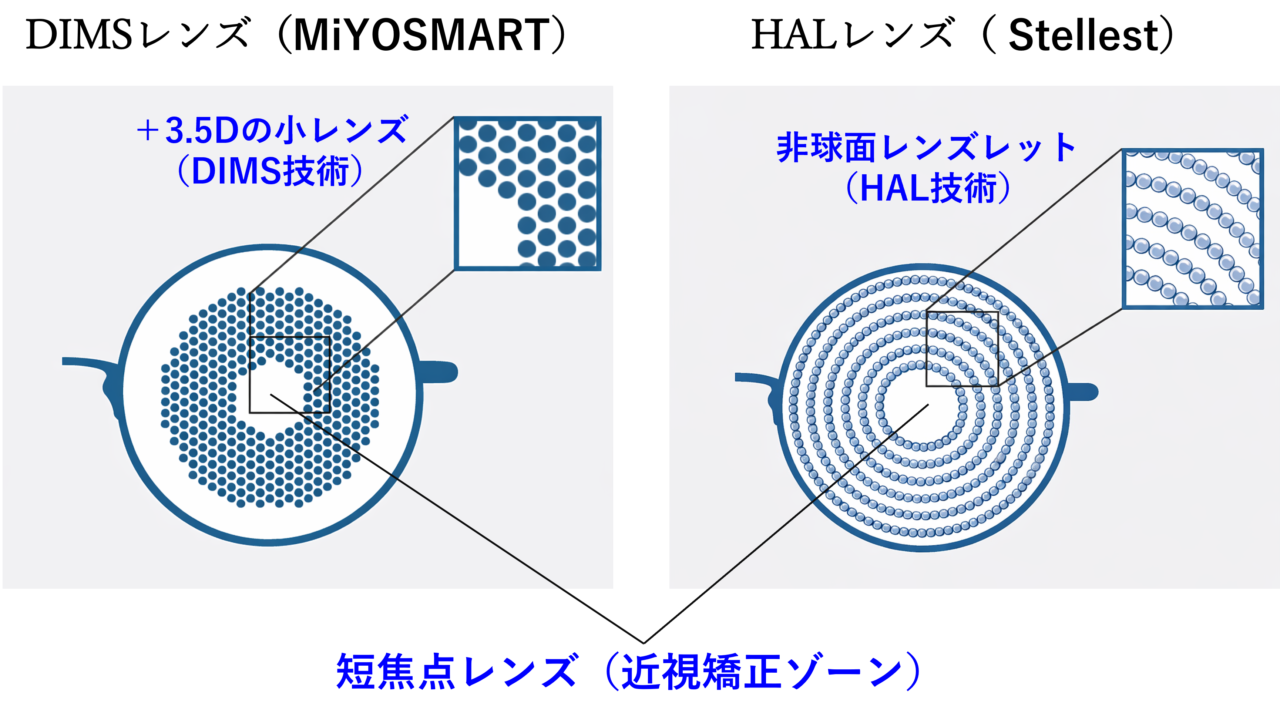 MiYOSMARTのDIMS構造とStellestのHAL構造の違い（多数の点状レンズと同心円状レンズの比較）