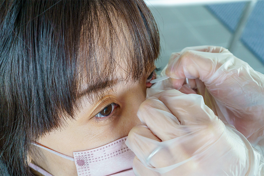 アデノウイルス迅速検査キットによる結膜炎の検査